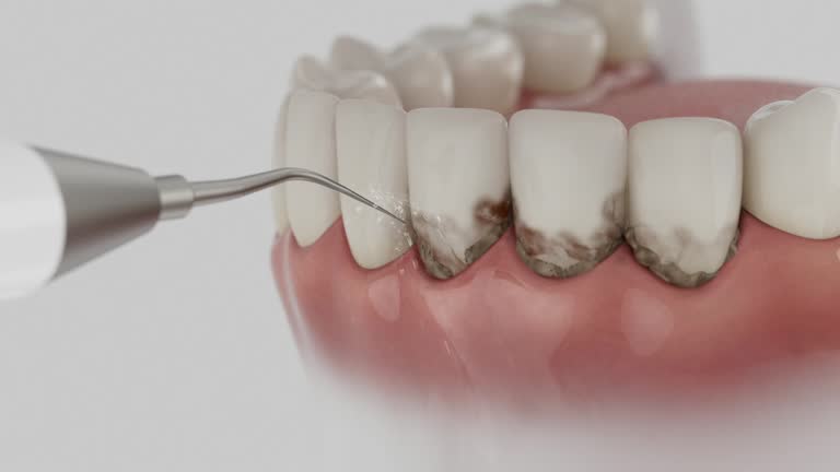 Trusted Emergency Dentist service in Hillcrest Heights, MD - Dentist Open Now